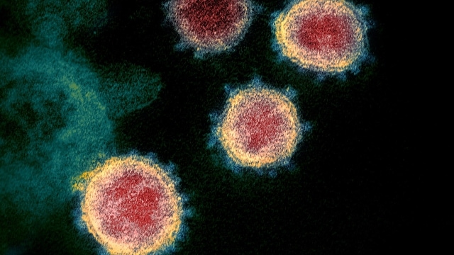 코로나19 전염병을 일으키는 바이러스의 실제 모습